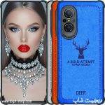 قاب نوا 9 SE هواوی
