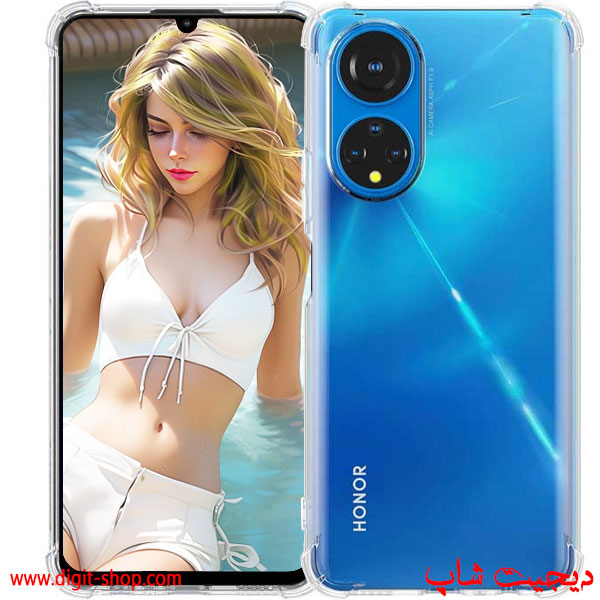 قاب آنر X7